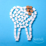 sorridi-ch-magazine-dentista-locarno-sigillatura-denti-bambini