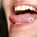 Sorridi-ch-magazine-diabete-e-parodontite
